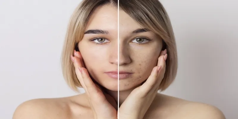 Milk proteins aiding skin
repair