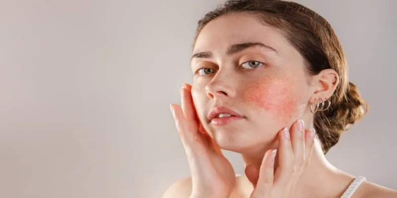 Skin sensitivity and sun protection