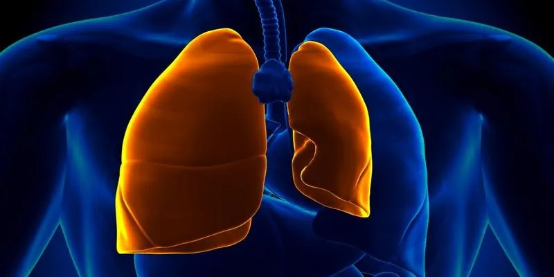 Illustration of
Pneumothorax