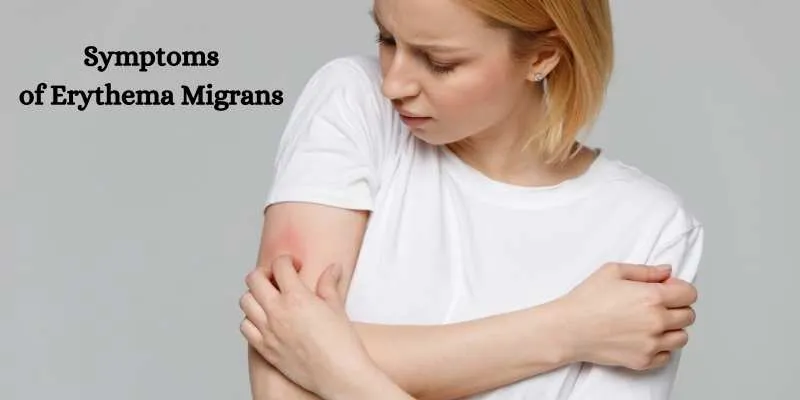 Erythema Migrans Rash Example
