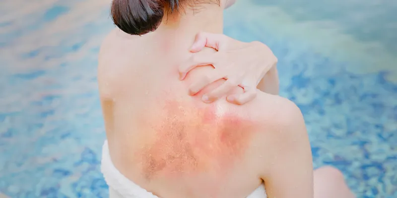 Apple Cider Vinegar