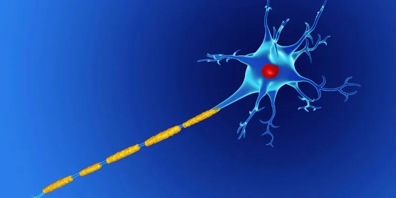 Illustration of Damaged Myelin
Sheath