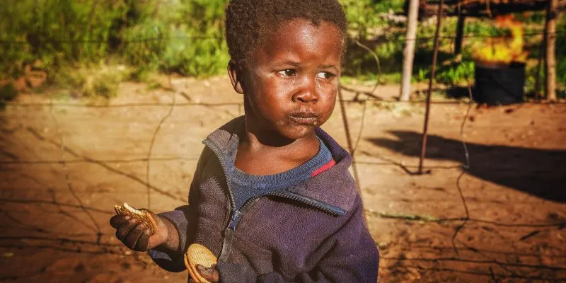 Child with signs of kwashiorkor