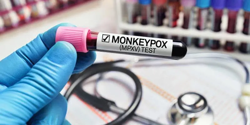 Comparison of monkeypox and
smallpox